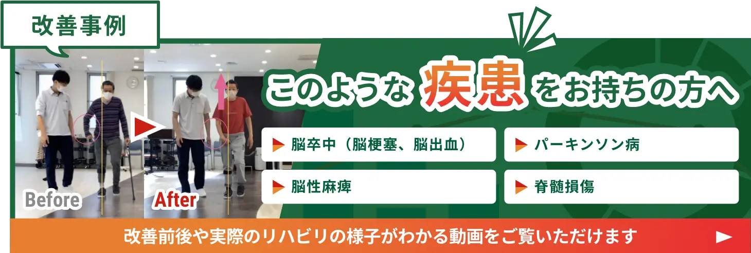 脳卒中リハビリテーション 08 脳卒中のリハビリテーション (Visual Lecture on Rehabilitation
