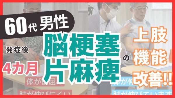 【発症後6か月】60代男性・武藤様・脳梗塞・歩行と上肢機能の改善事例②　