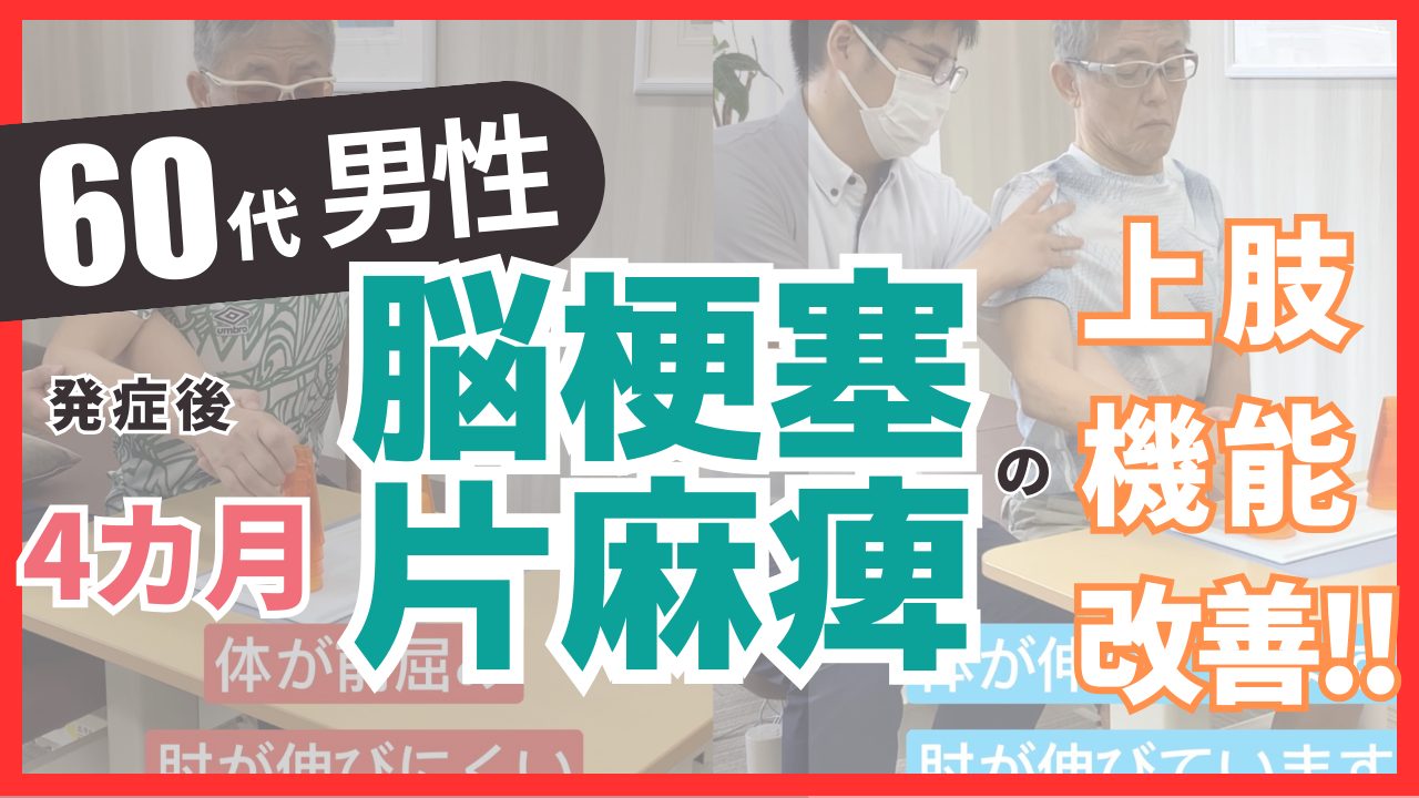 【発症後4か月】60代男性・武藤様・脳梗塞・右片麻痺の改善事例