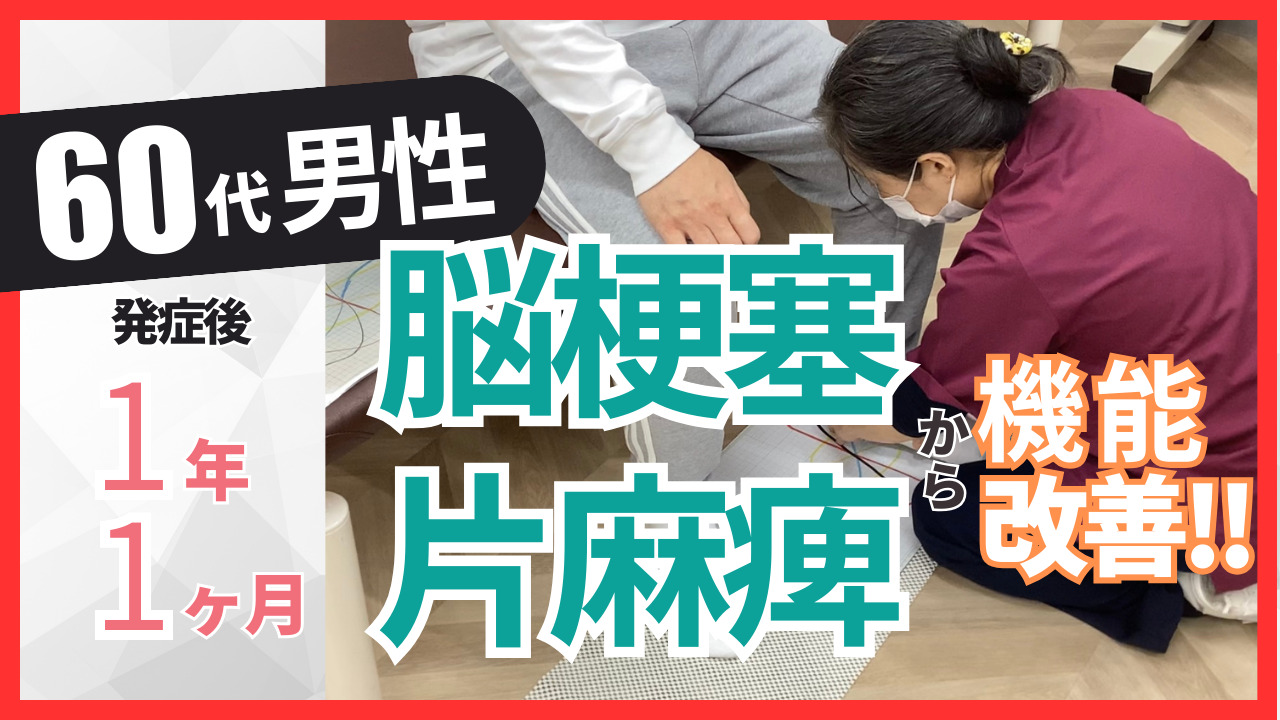 【発症後1年1ヵ月】 60代・男性・岩崎卓也様・脳梗塞・左片麻痺の改善事例