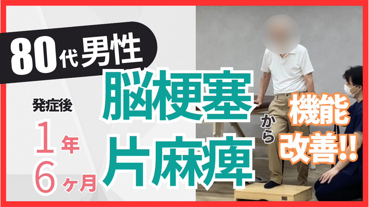 【発症後1年6ヶ月】80歳代・男性・脳梗塞・左片麻痺の改善事例③