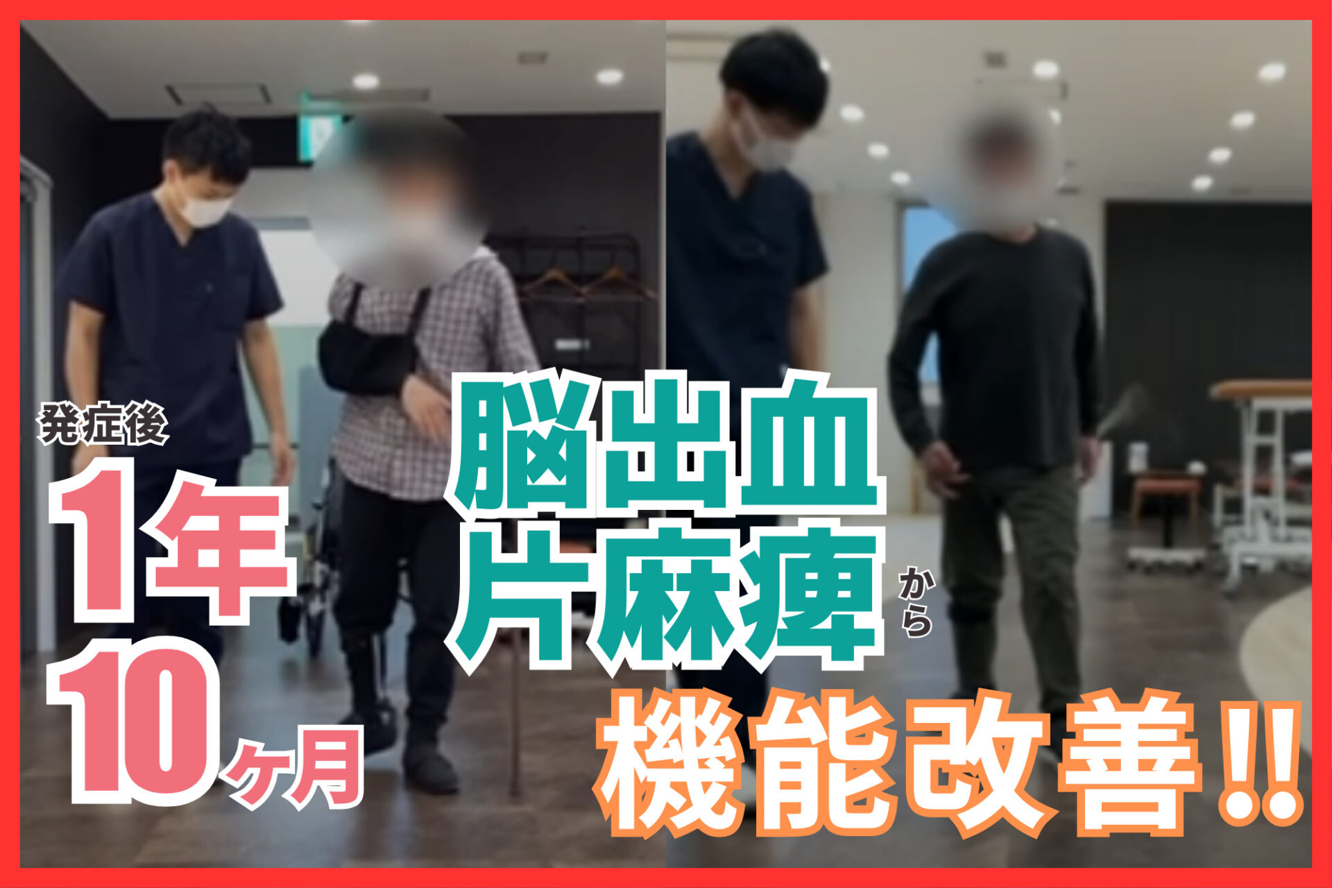 【発症後1年10カ月】60代・男性・脳出血 改善事例
