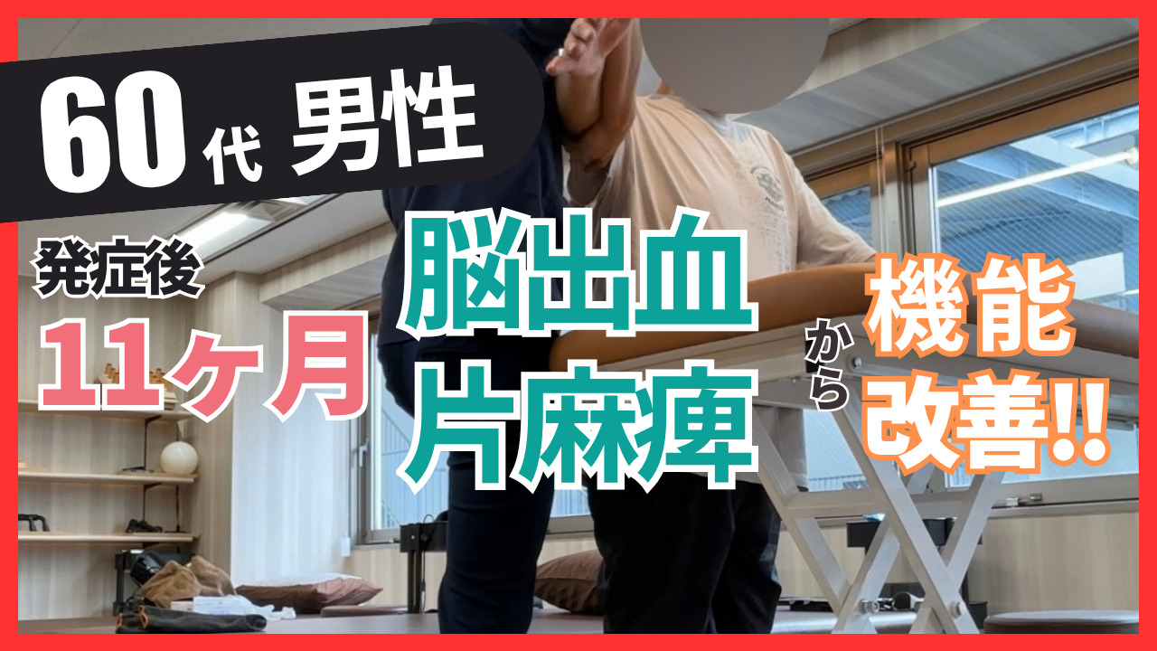 【発症後11ヶ月】60代・男性・脳出血・右片麻痺の上肢機能の改善事例