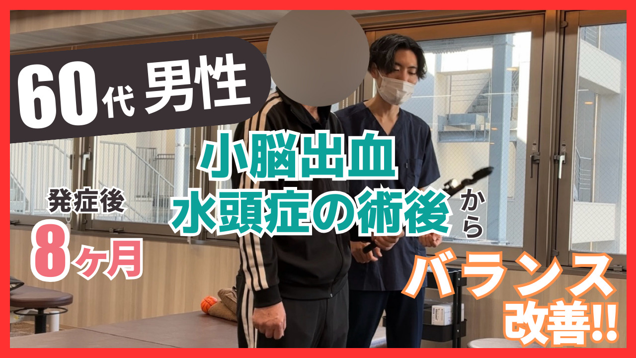 【発症後8ヶ月】60代男性・小脳出血、水頭症の術後・バランス機能の改善事例