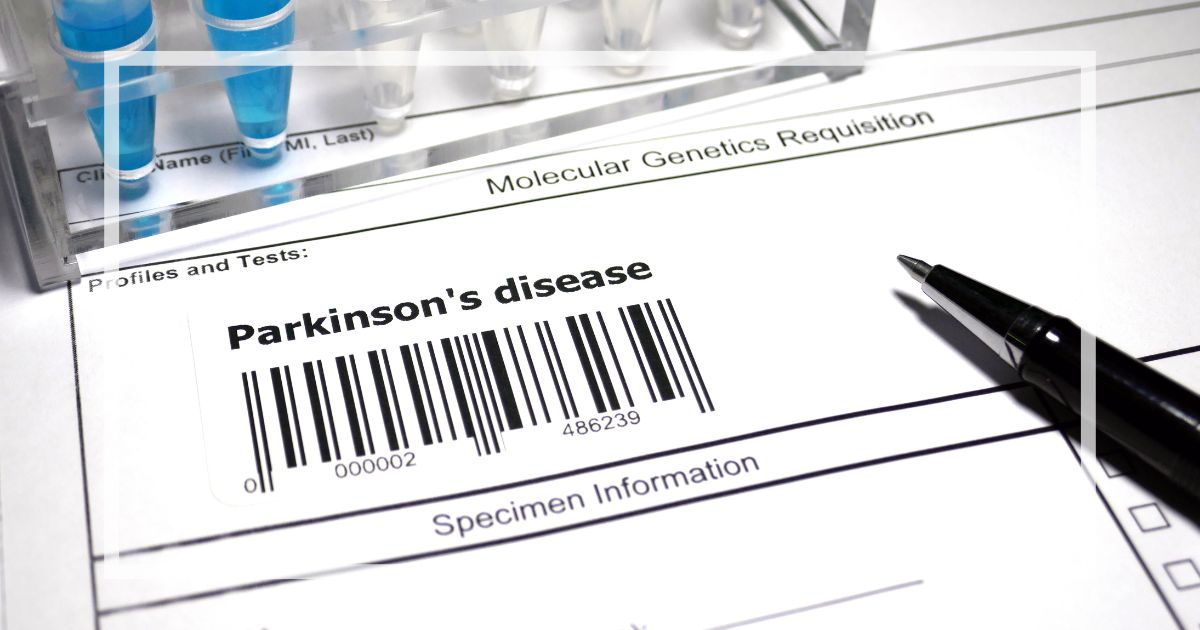 パーキンソン病の寿命への影響