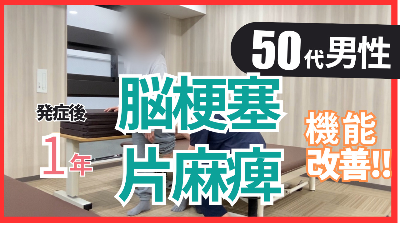 【発症後1年】50代男性・脳梗塞の改善事例