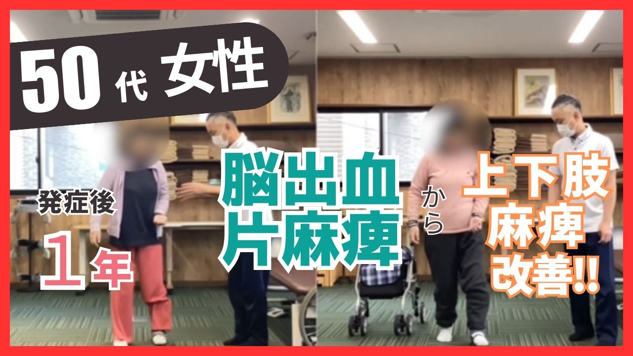 【発症後 約1年】５０代女性・左上下肢麻痺の改善事例