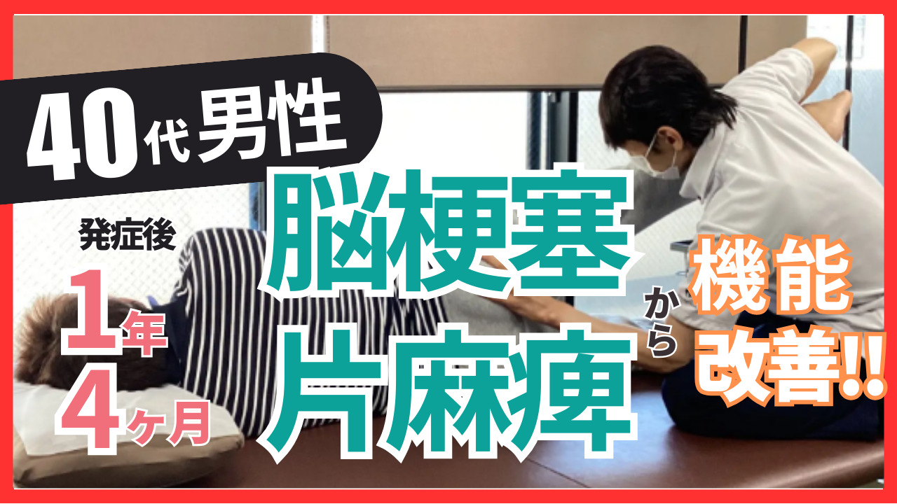 【発症後1年４か月】40代男性・AN様・左脳梗塞の改善事例