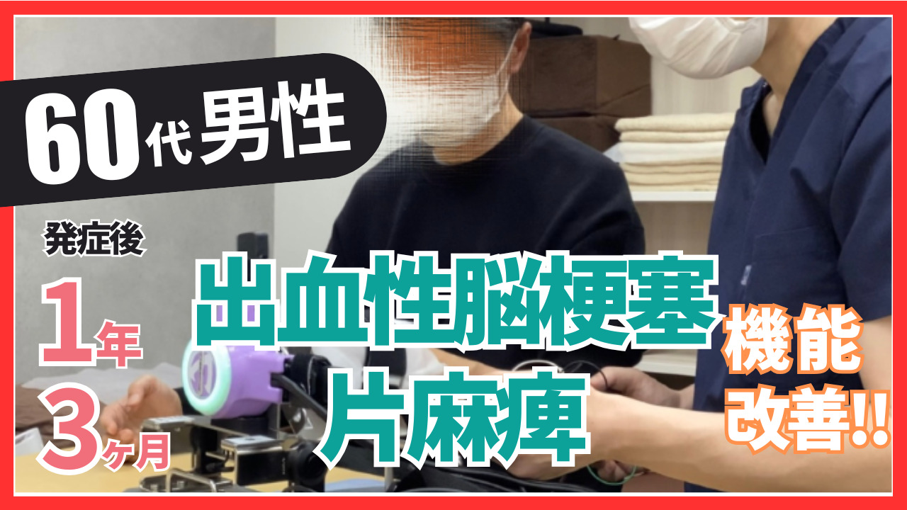 【発症後1年3ケ月】60代男性・S.U様・出血性脳梗塞・左片麻痺の改善事例