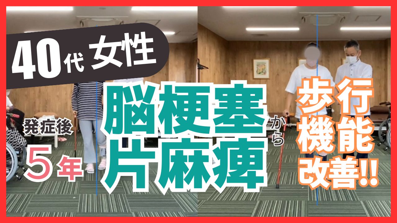 【発症後5年】40代女性・脳梗塞・左片麻痺の改善事例