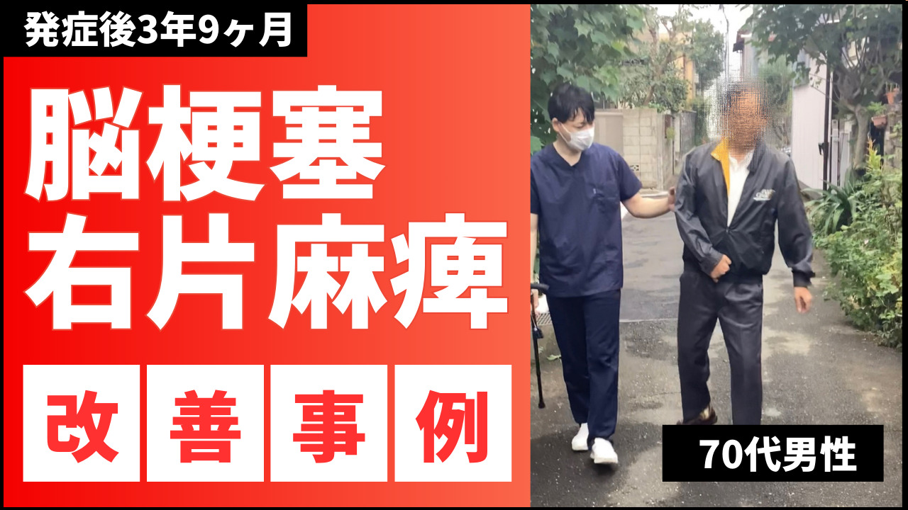 【発症後3年9ヵ月】70代男性・YI様・脳梗塞・右片麻痺の改善事例③