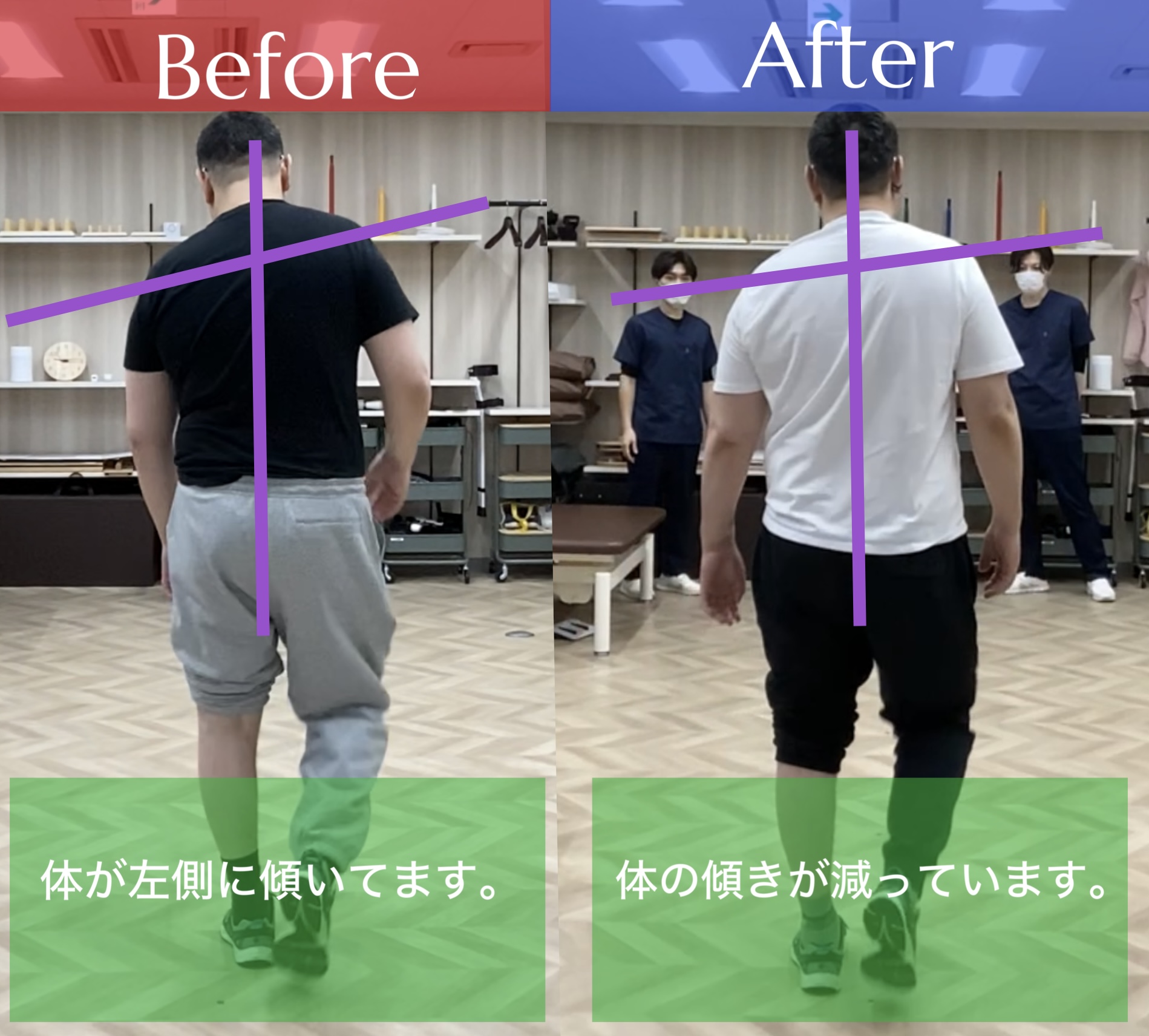 リハビリ中の画像