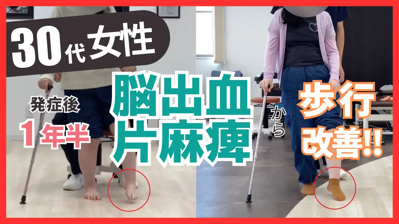 脳卒中後遺症者へのニューロリハビリテーション　　　【全4巻】ME180-S 61Zj9s0ZPhL.jpg