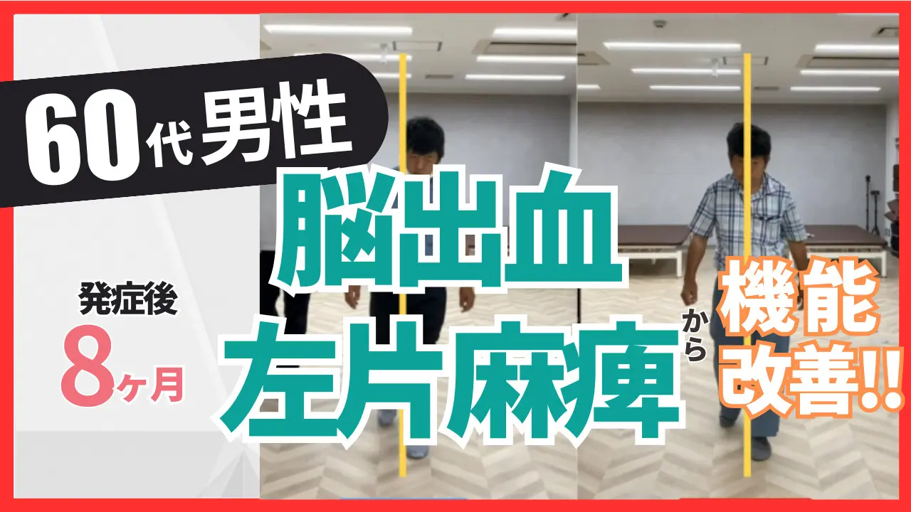 脳卒中後遺症者へのニューロリハビリテーション　　　【全4巻】ME180-S 理学療法ジャーナル Vol.56 No.4 | 雑誌詳細 | 雑誌 | 医学書院