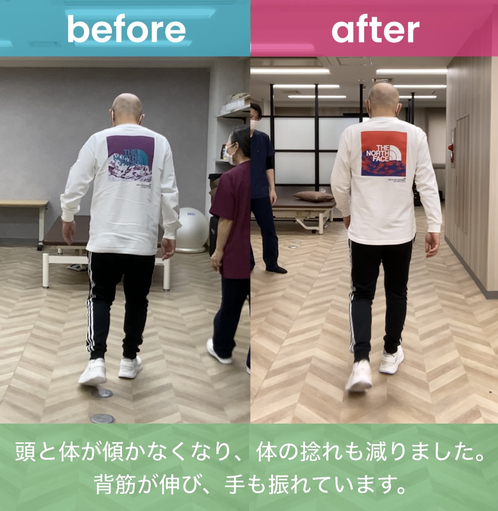 リハビリ中の画像