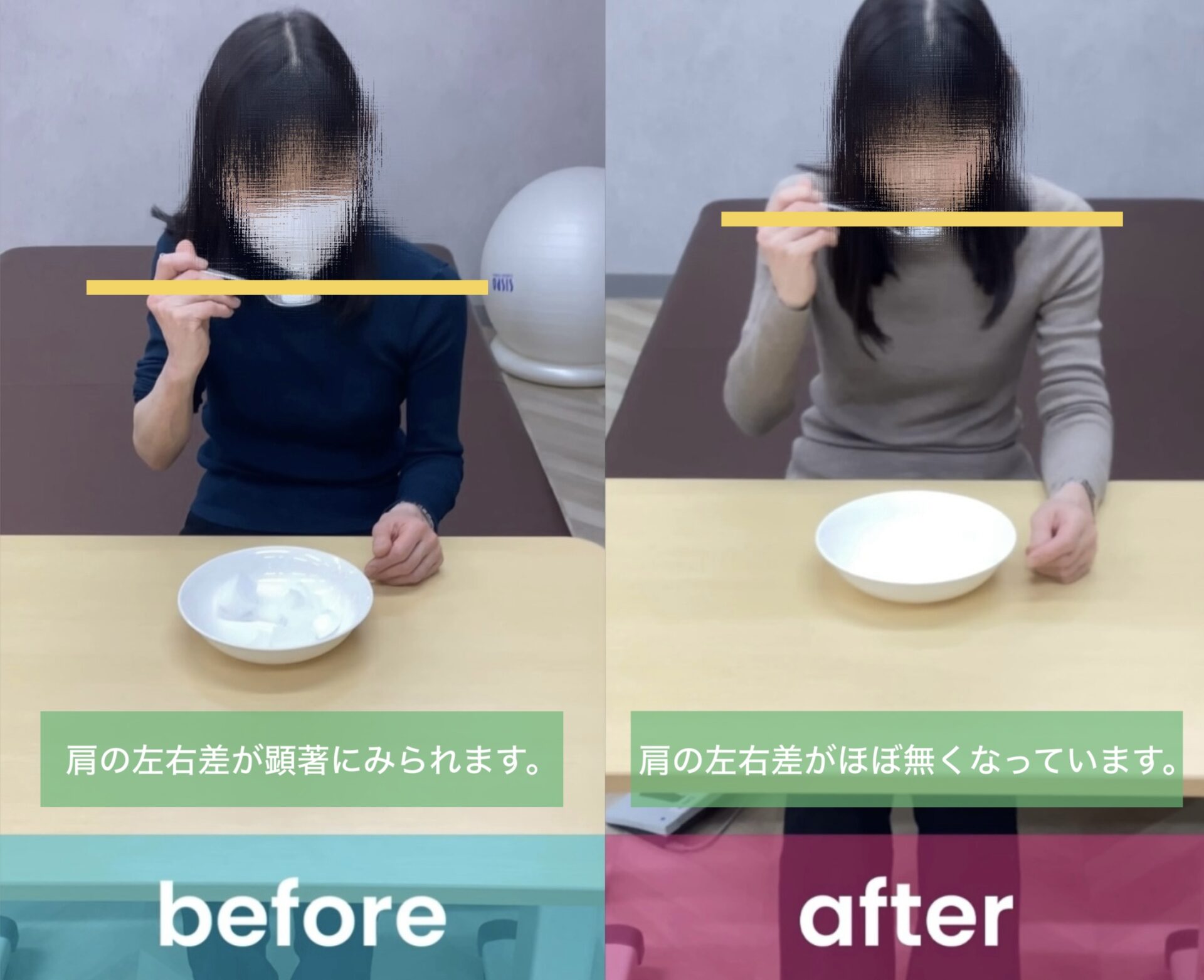 リハビリ中の画像