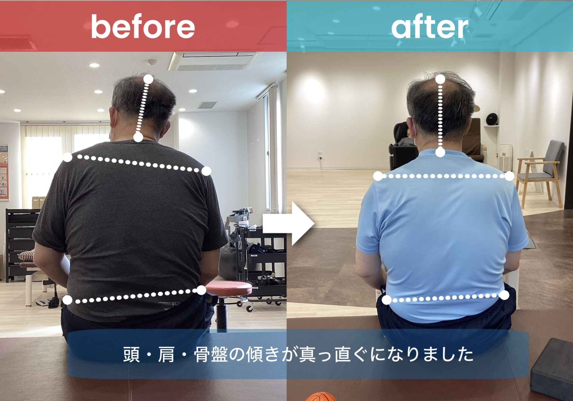 リハビリ結果の画像