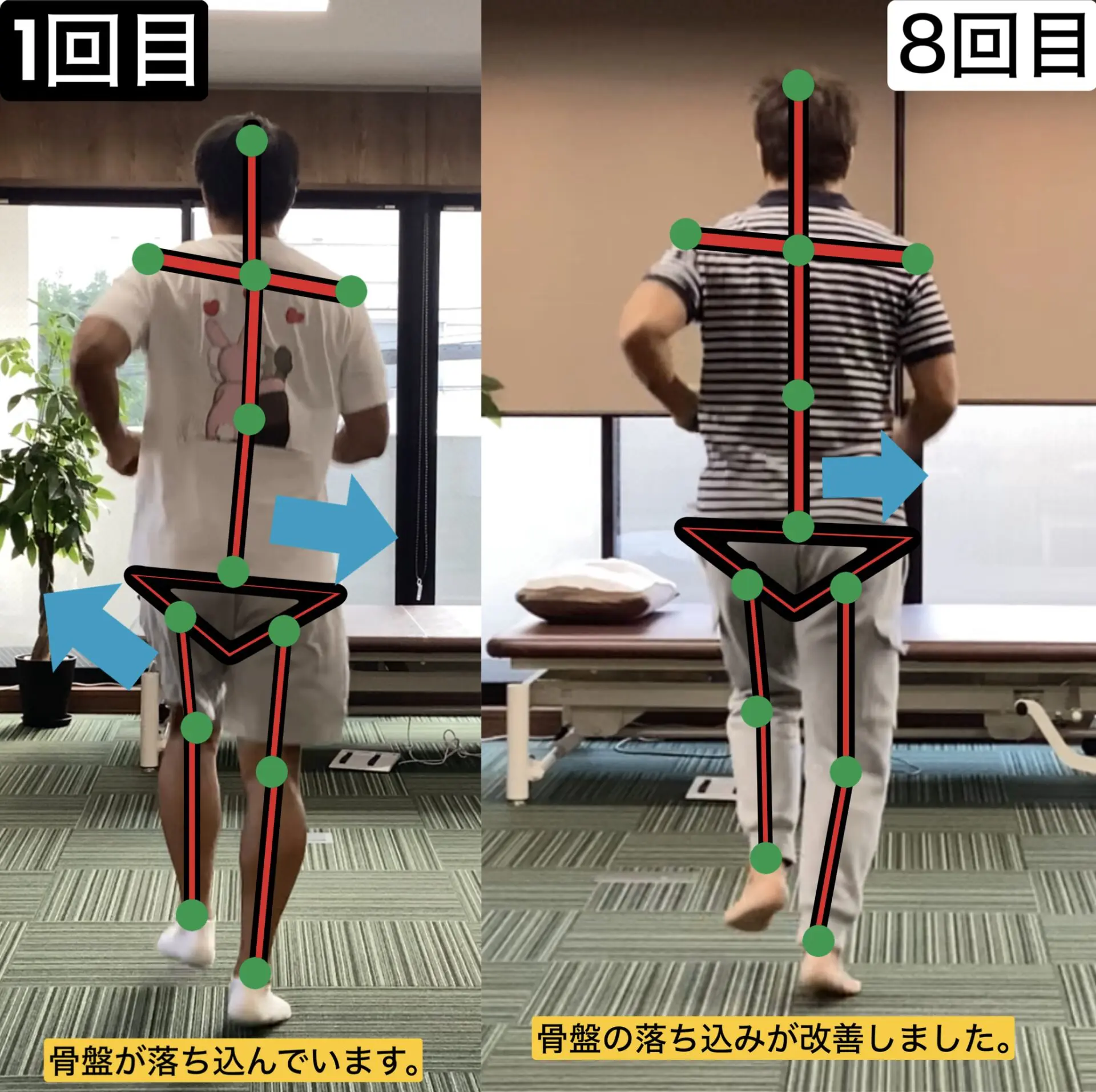 脳卒中後遺症者へのニューロリハビリテーション　　　【全4巻】ME180-S 動画 - 脳卒中・脳梗塞・脳出血の後遺症改善 - 脳神経リハビリ