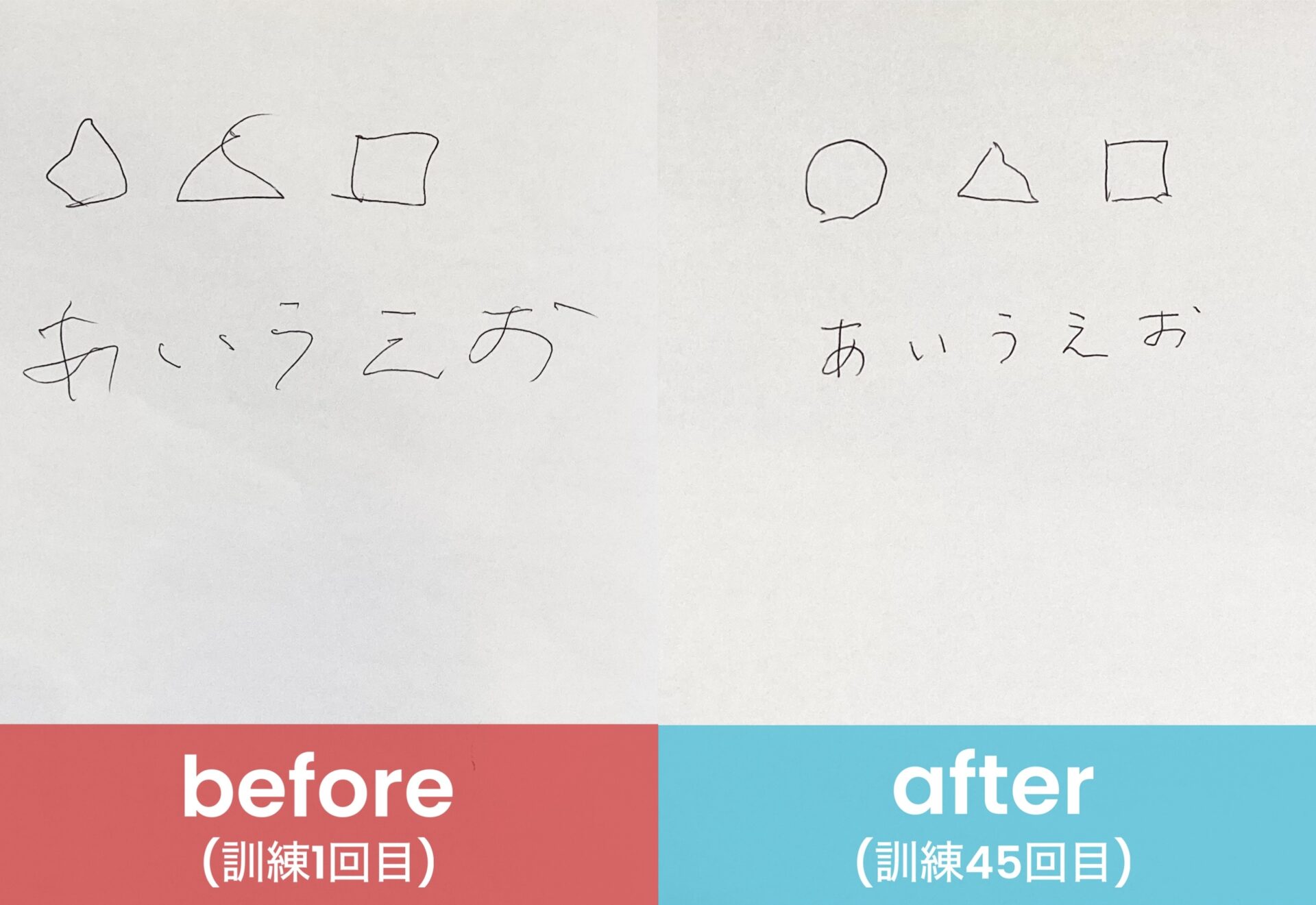 リハビリ結果の画像