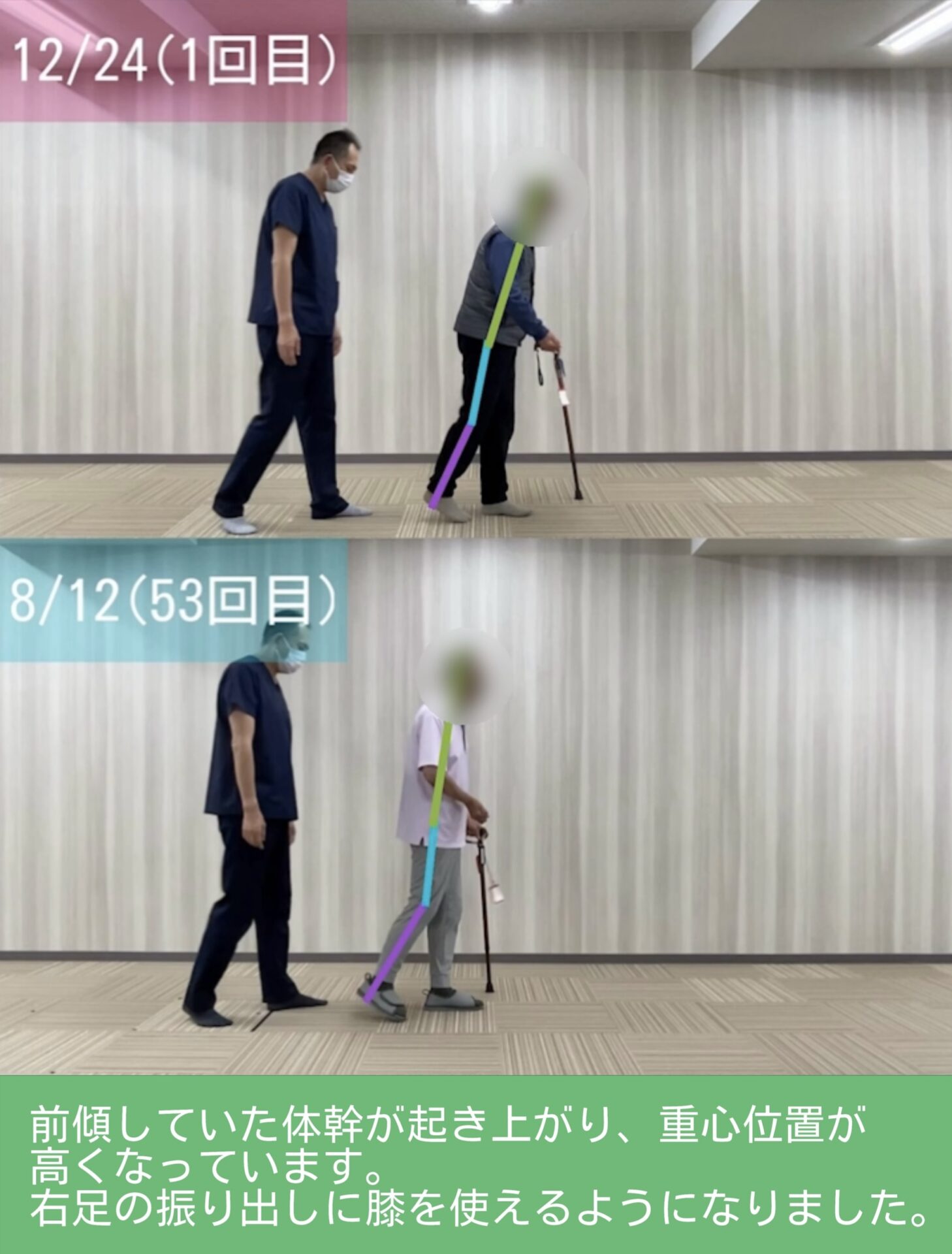 リハビリ結果の画像