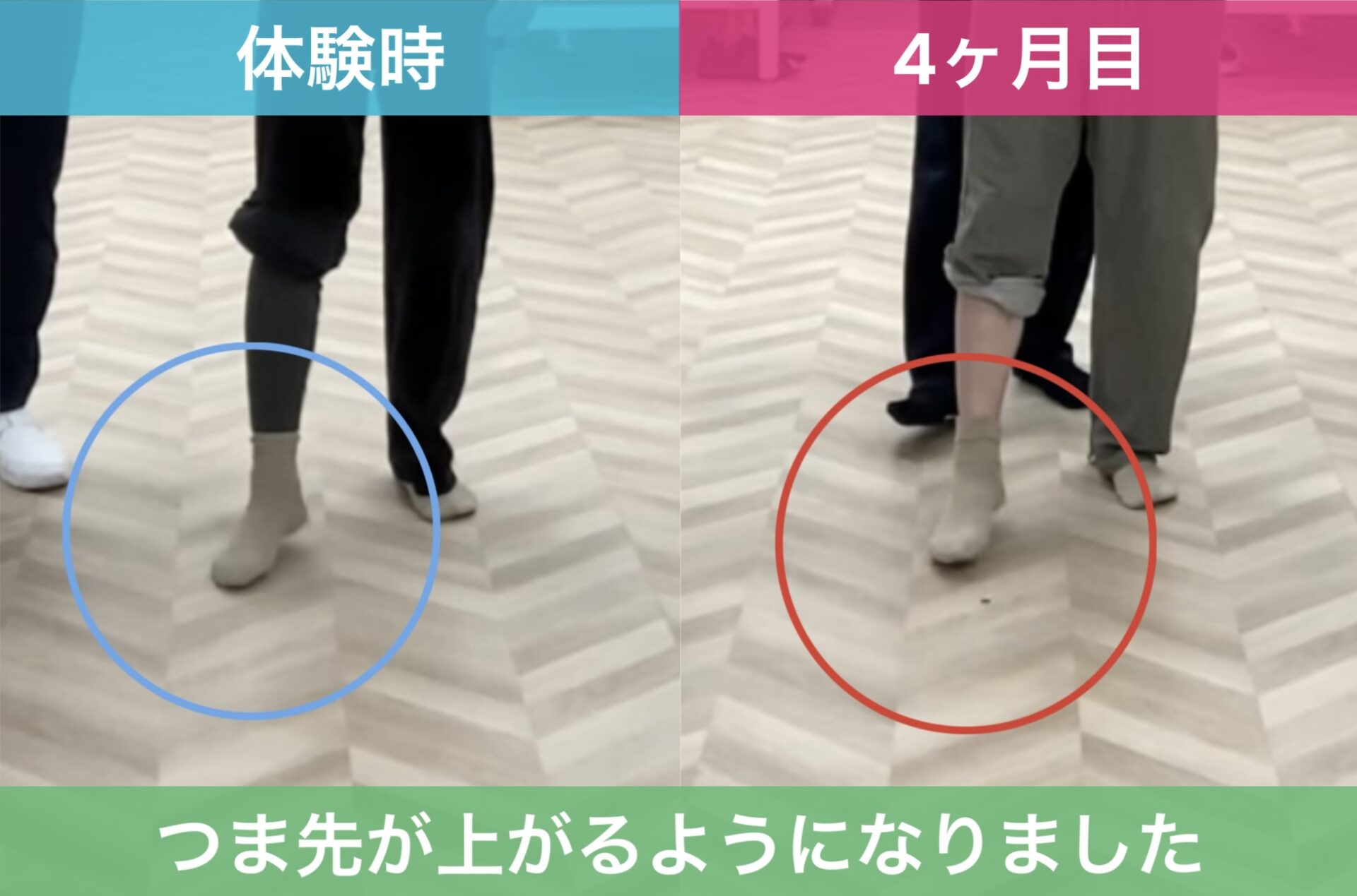 リハビリ中の画像