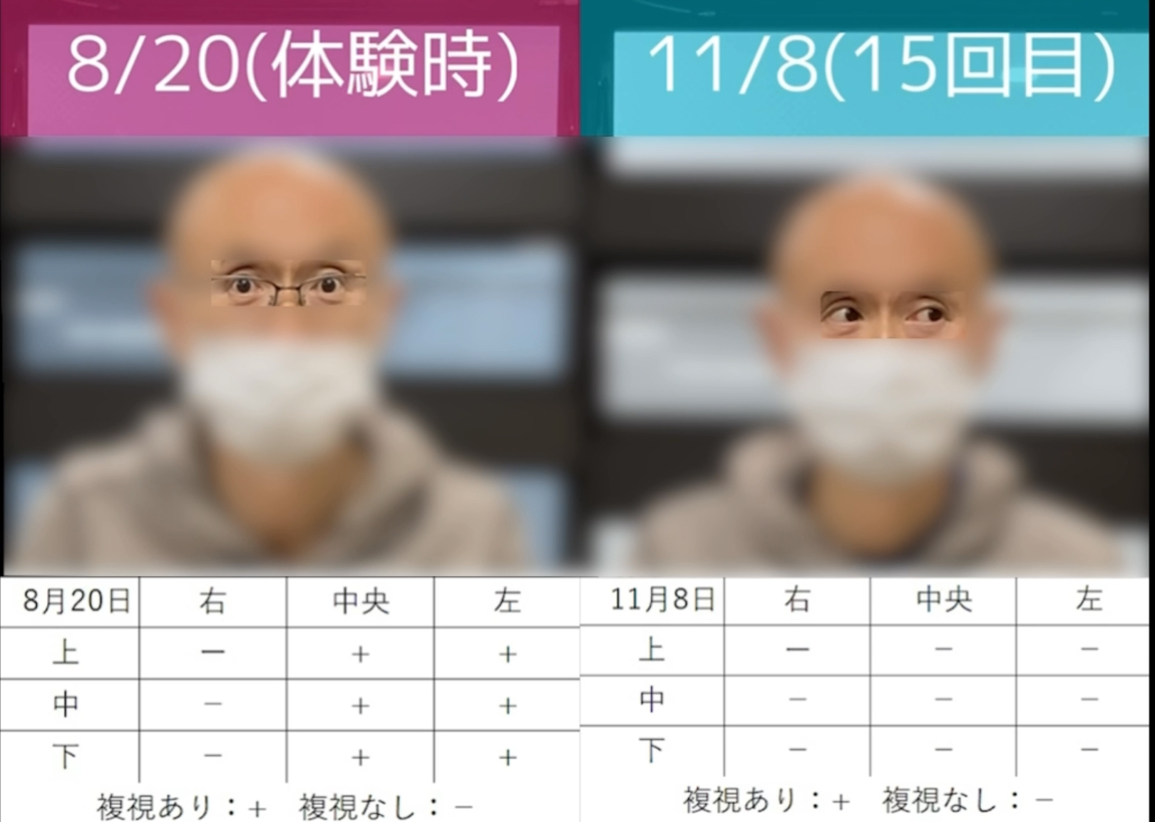 リハビリ結果の画像