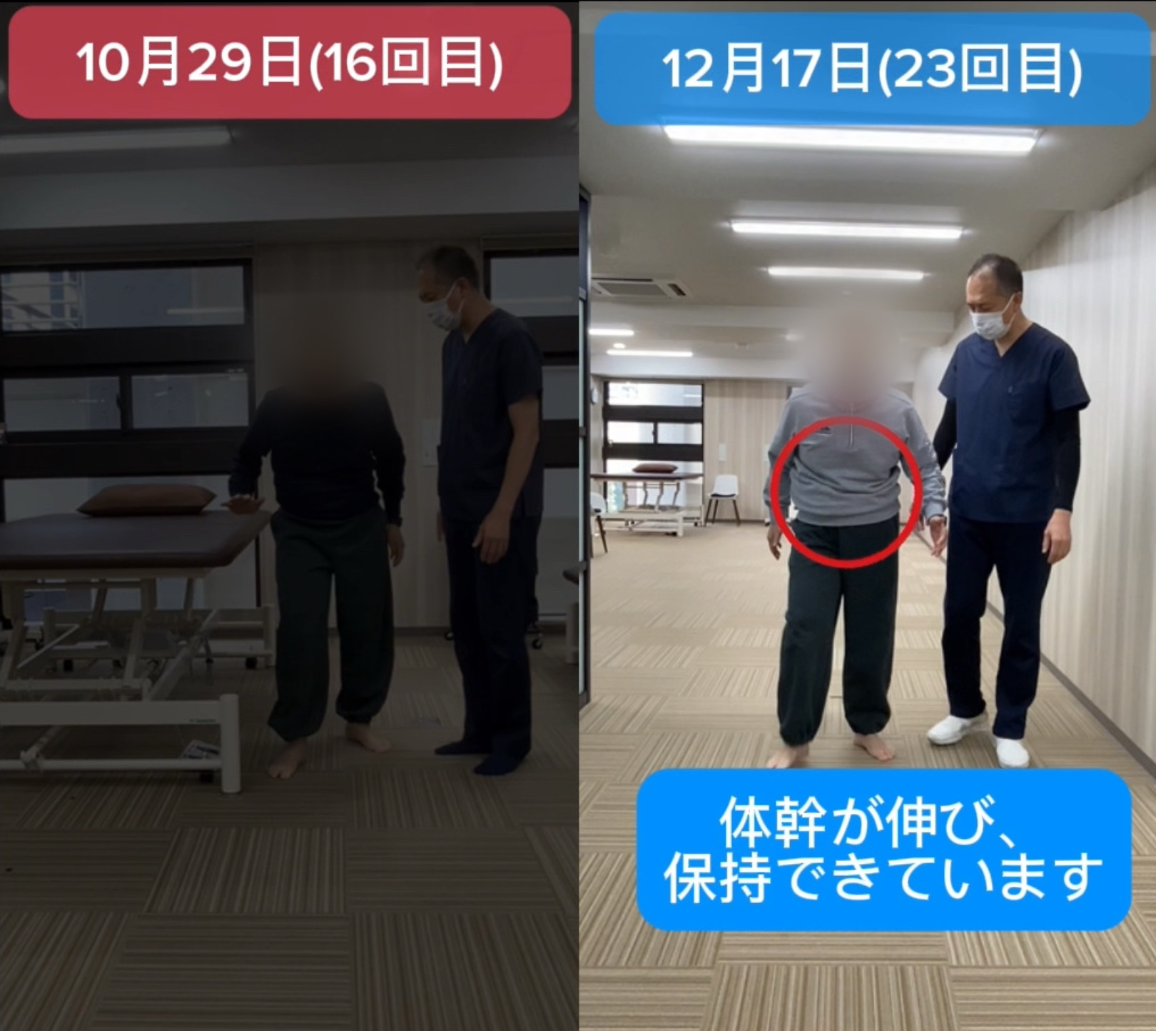 リハビリ結果の画像