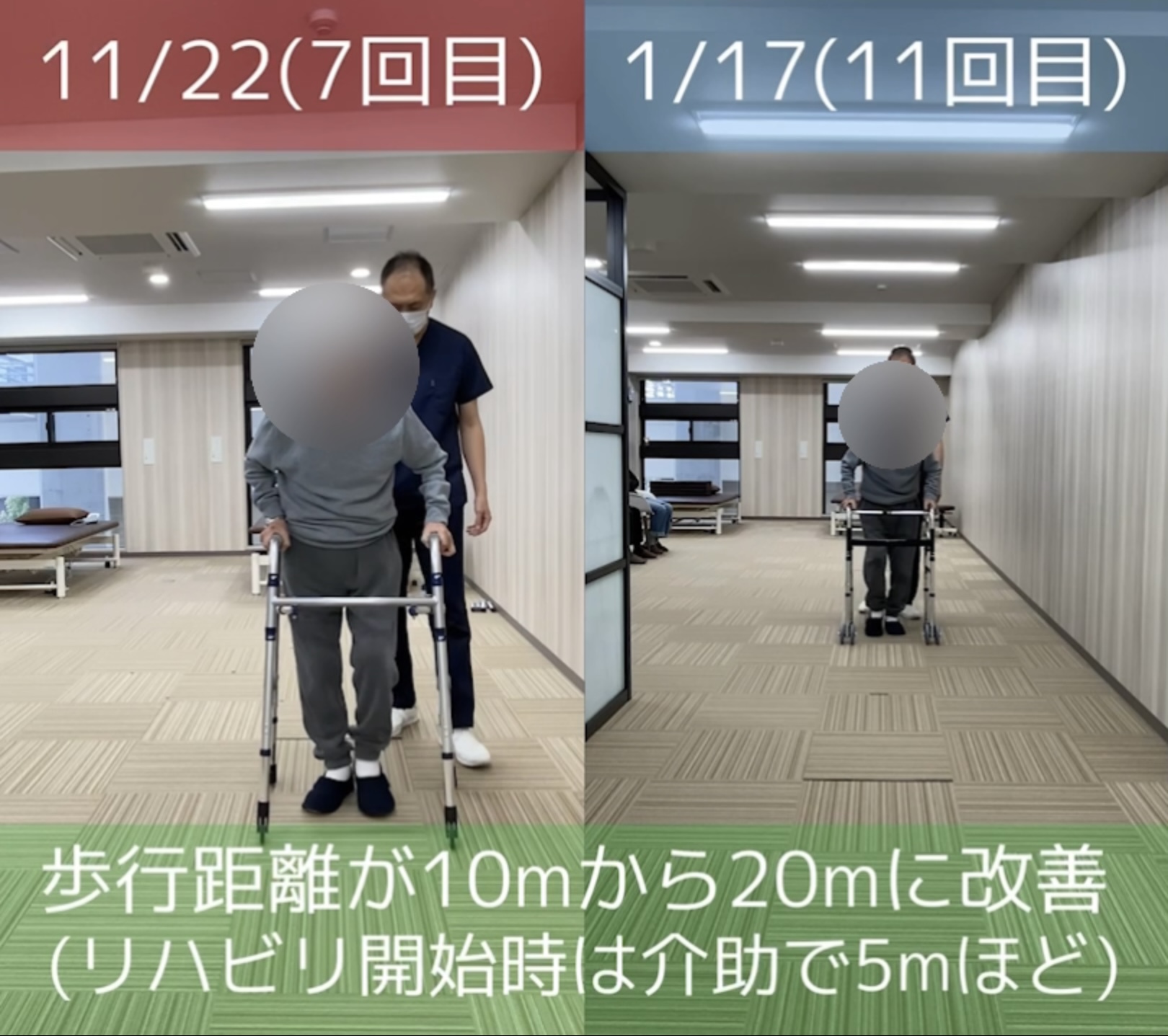 リハビリ結果の画像