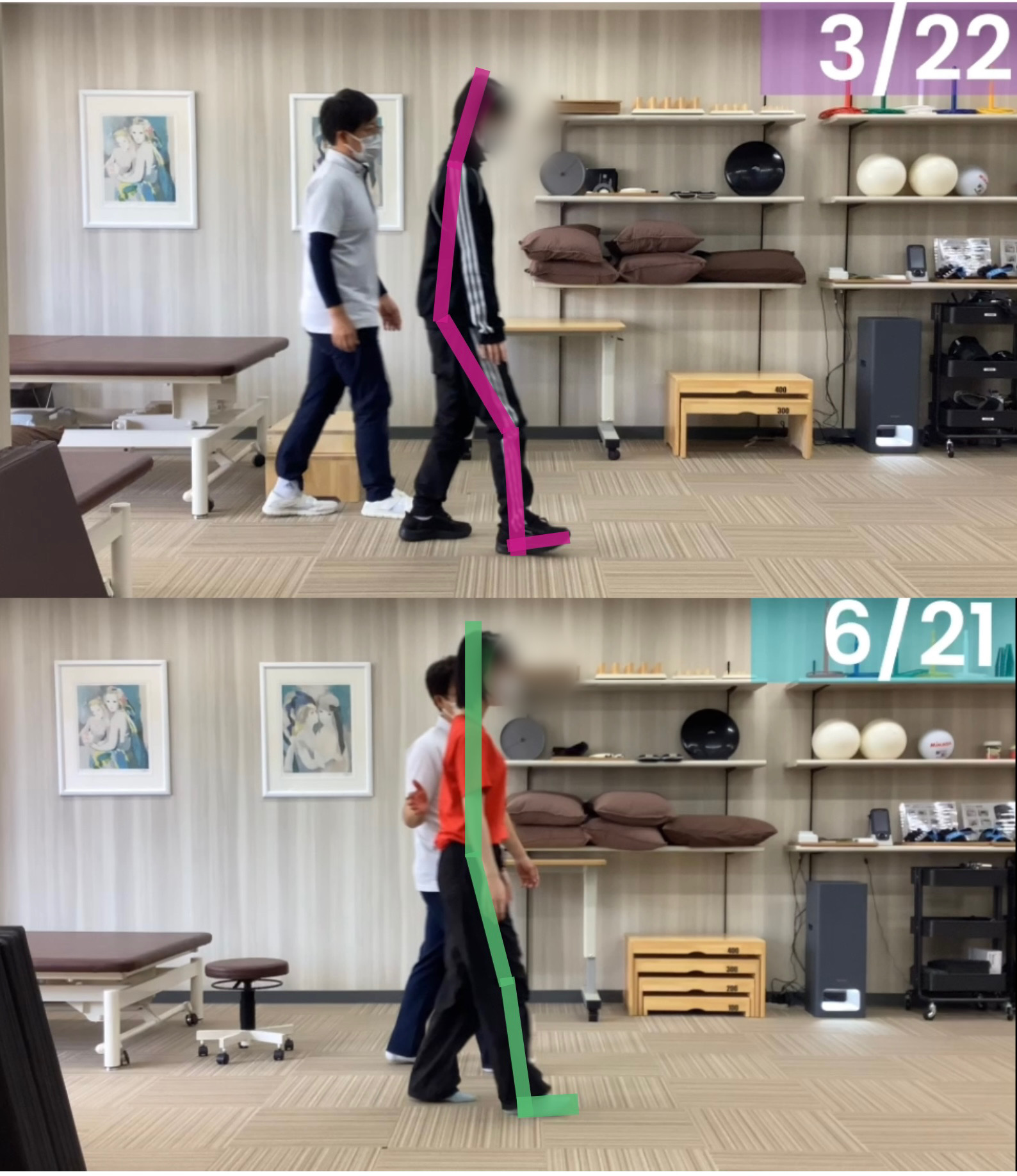 リハビリ結果の画像