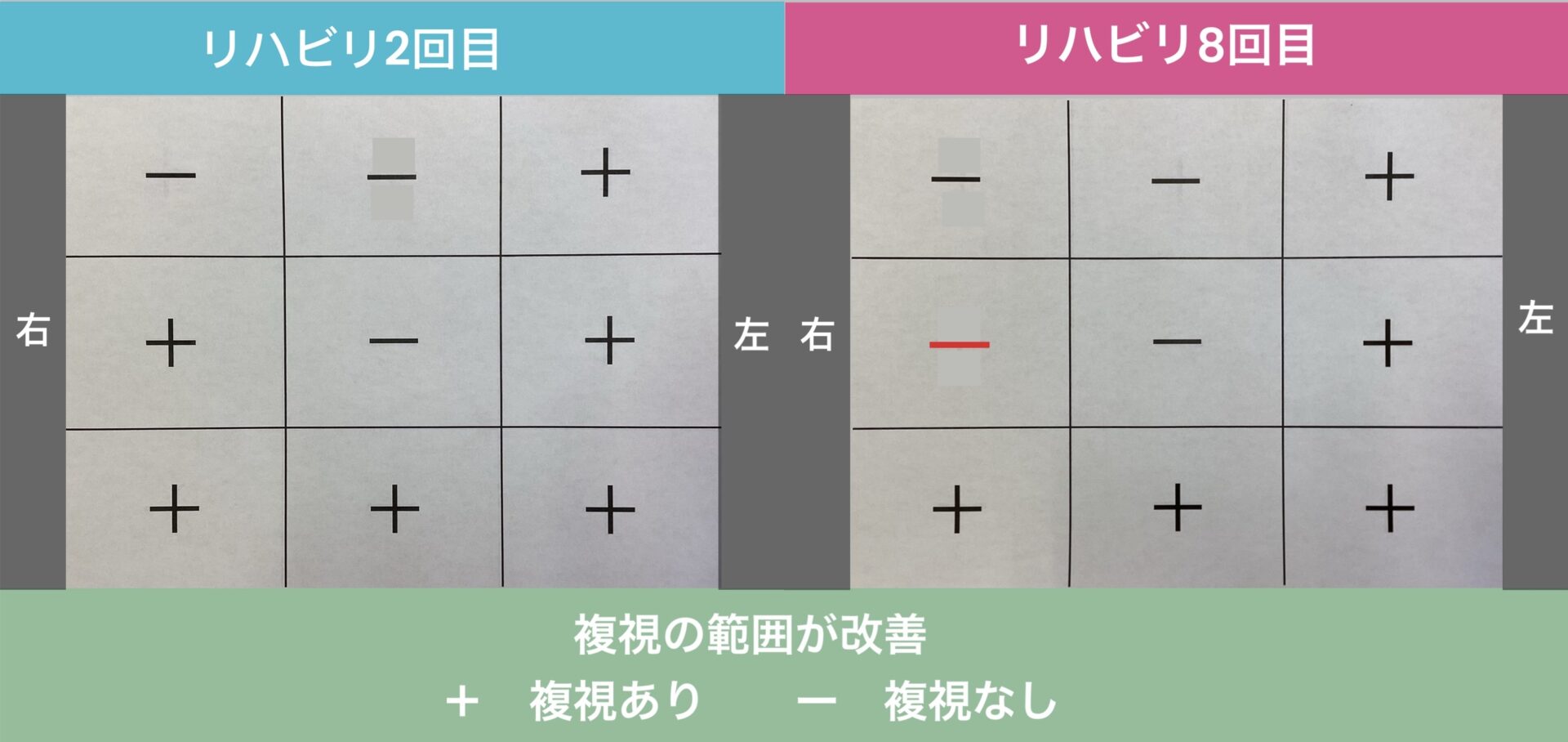 リハビリ結果の画像