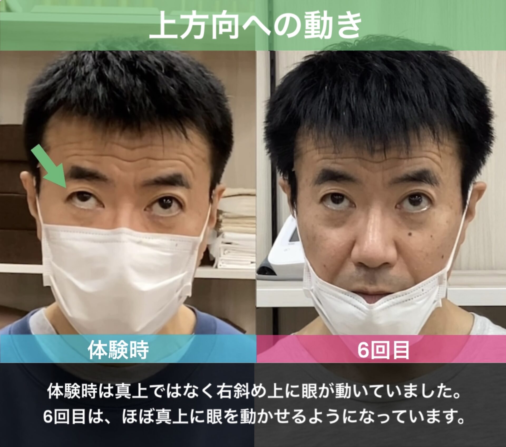 リハビリ中の画像