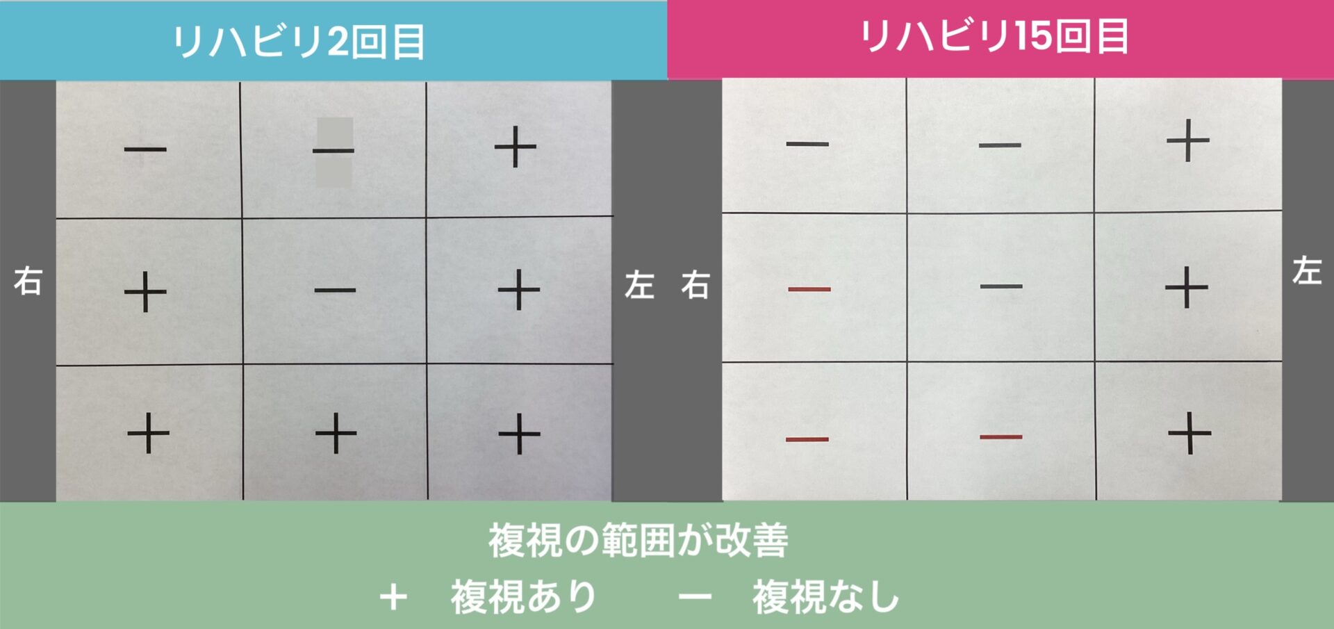 リハビリ結果の画像