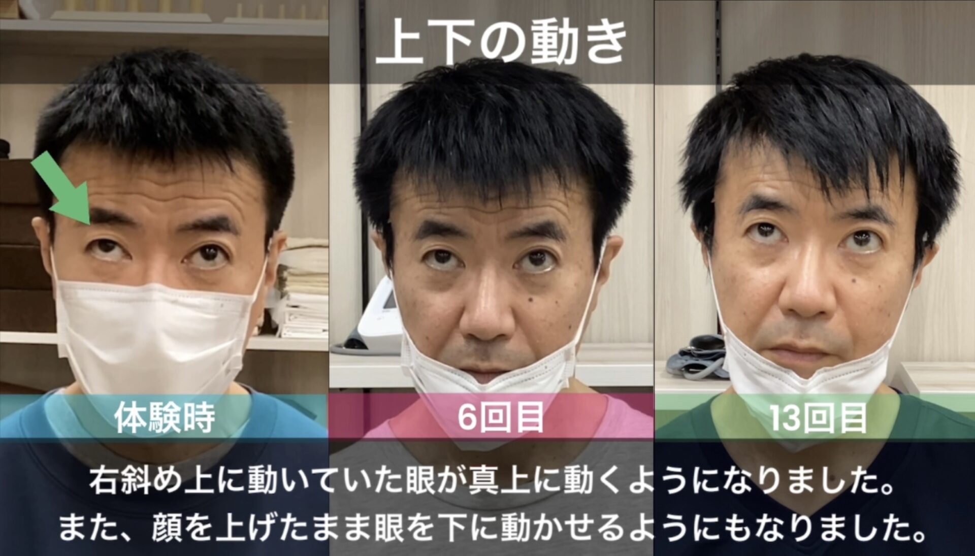 リハビリ中の画像
