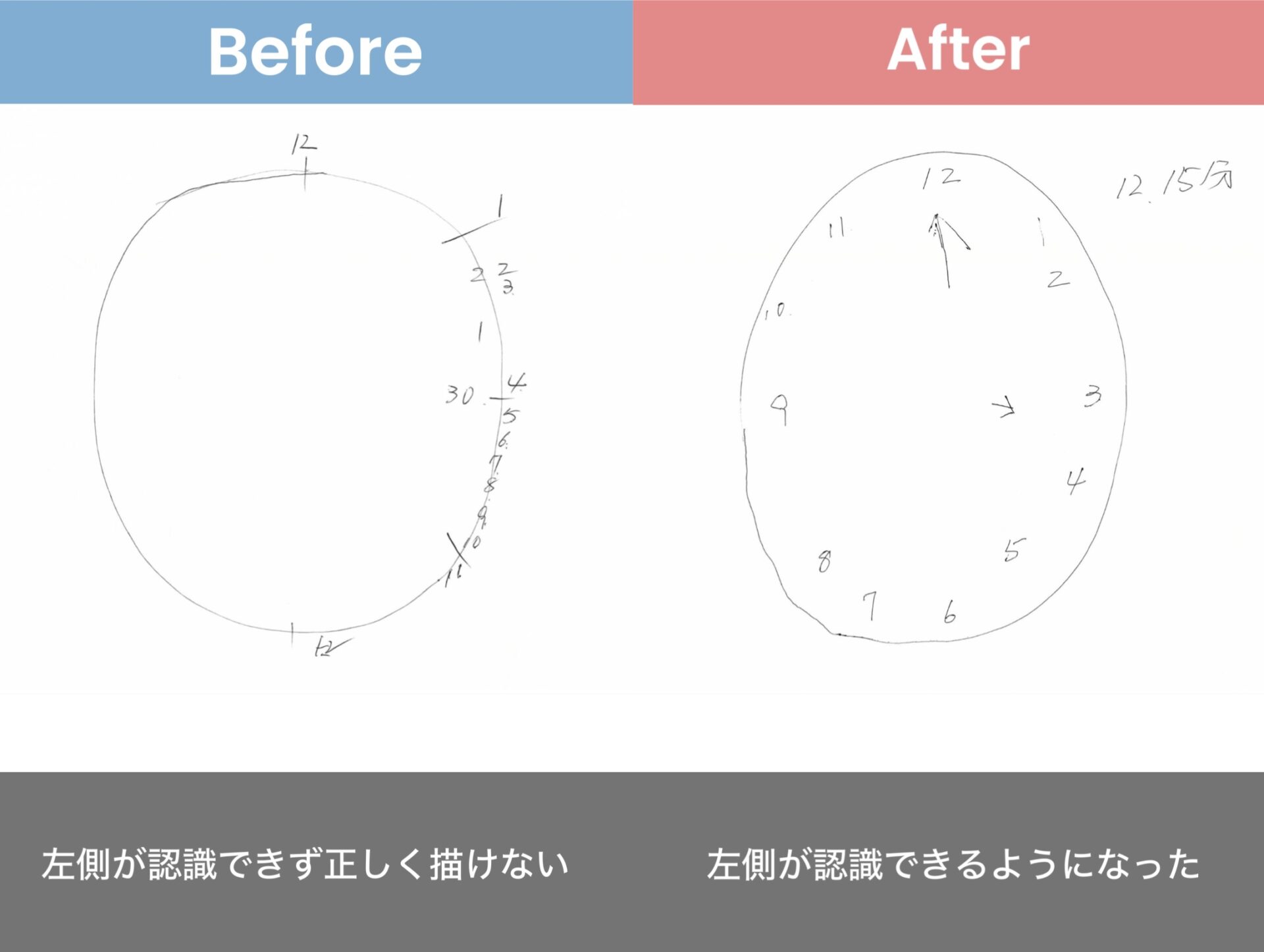 リハビリ結果の画像