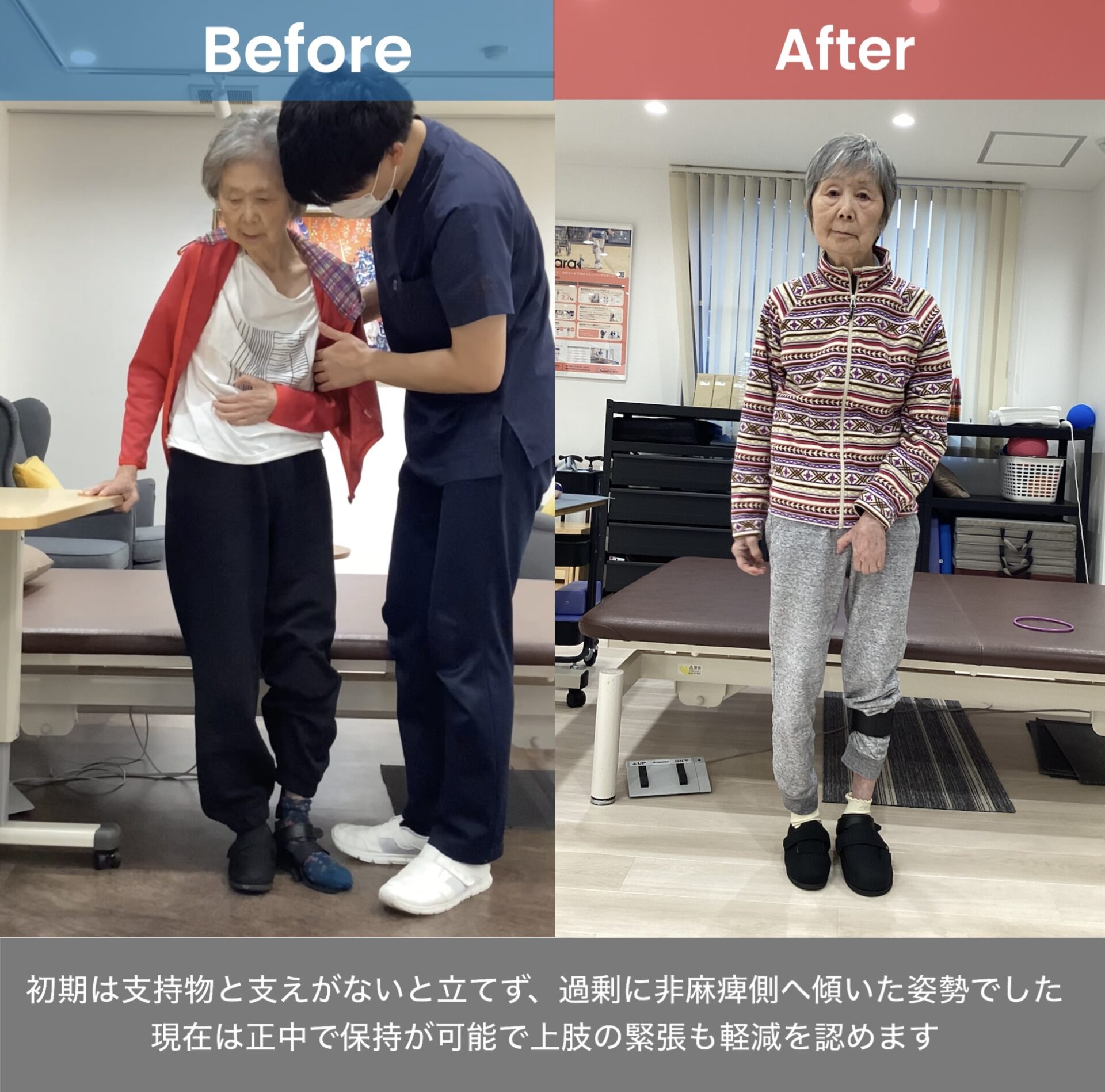 リハビリ中の画像