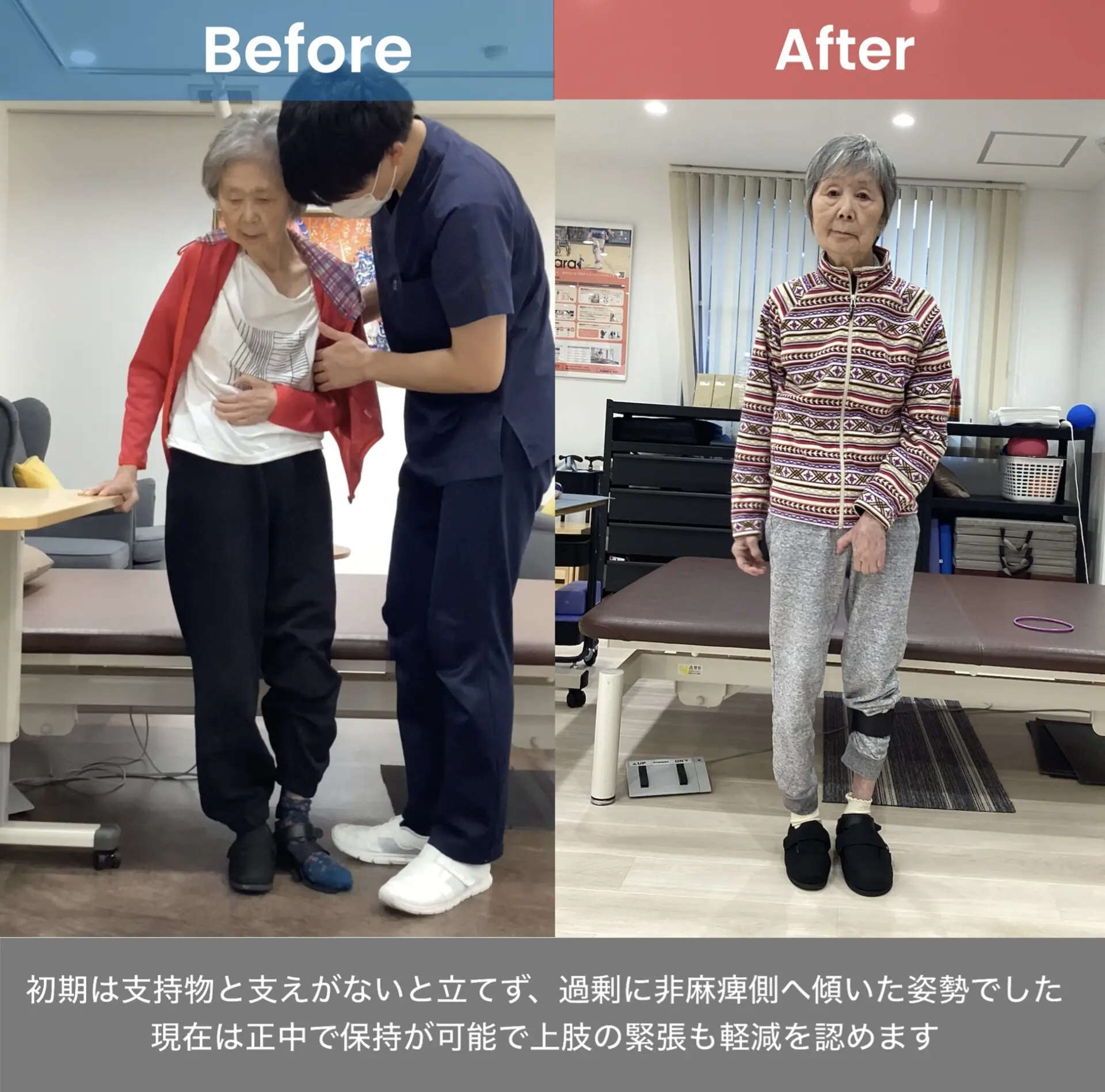 脳卒中後遺症者へのニューロリハビリテーション　　　【全4巻】ME180-S 61Zj9s0ZPhL.jpg