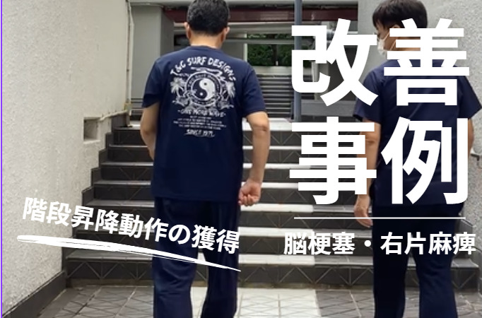 【発症1年】60代男性 青木茂様 「できる」を積み重ねて ― 職場復帰に向けた階段への挑戦④
