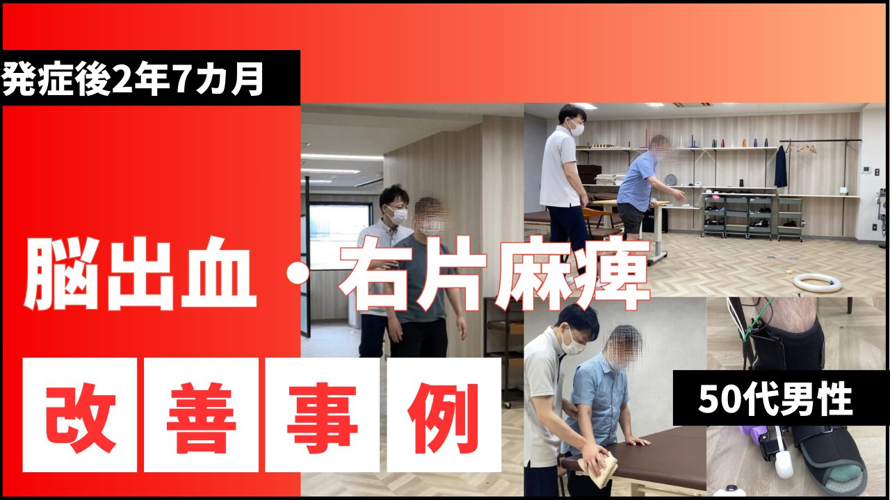 【発症2年7ヶ月】50代男性・HM様・脳出血・右片麻痺の改善事例②