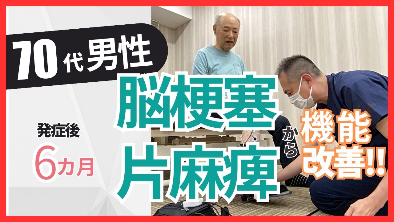 【発症後６ヶ月】70代男性・矢吹様・脳梗塞・右片麻痺の改善事例