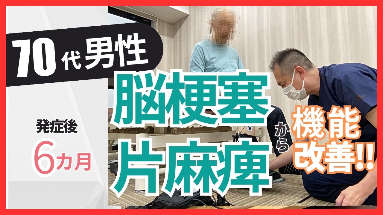 【発症後６ヶ月】70代男性・A様・脳梗塞・右片麻痺の改善事例