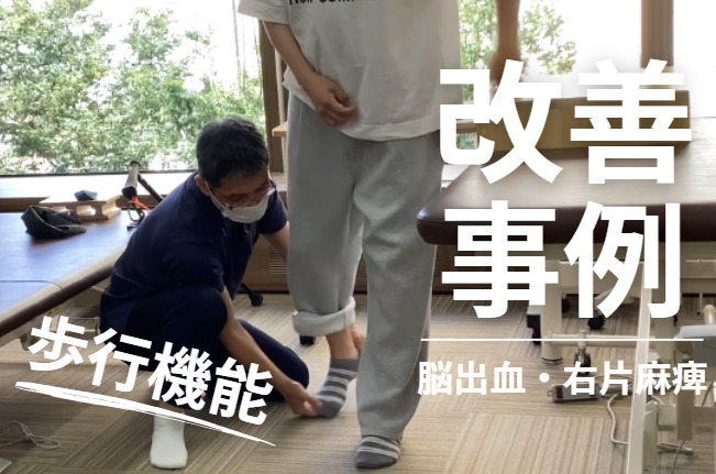 【発症後10か月】40代男性・K.I様|左被殻出血による右片麻痺|装具なしでの安定した歩行を目指した改善事例