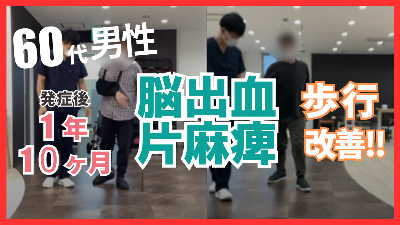 【発症後1年10カ月】60代・男性・脳出血 改善事例