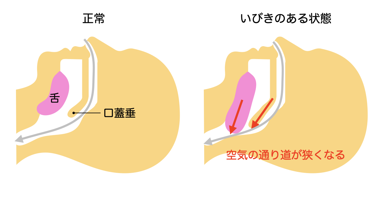  12. 血管疾患