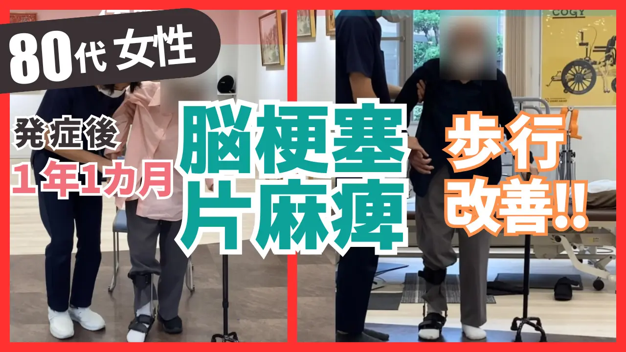 発症後1年1ヶ月】80歳代・女性・脳梗塞の改善事例 - 脳卒中・脳